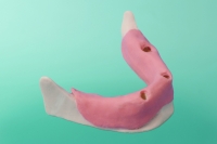 Unterkiefer mit Zahnfortsatz 10-3010