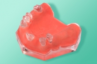 Transparentes Modell des Kiefers mit den Zähnene 10-5126