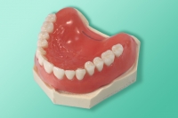 Modell für die Demonstrationstechnik von allen auf vier Zahnimplantaten 10-5017
