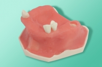Modell eines teilweise zahnlosen Kiefers mit Nebenhöhlen und Schleimhäuten 10-3100